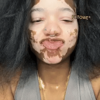 (🎁2025-ös Újévi Akció🎁 50% Kedvezmény🎁)PLTOWE® Méhméreg All-in-One krém US Bőrgyógyászatilag elfogadott