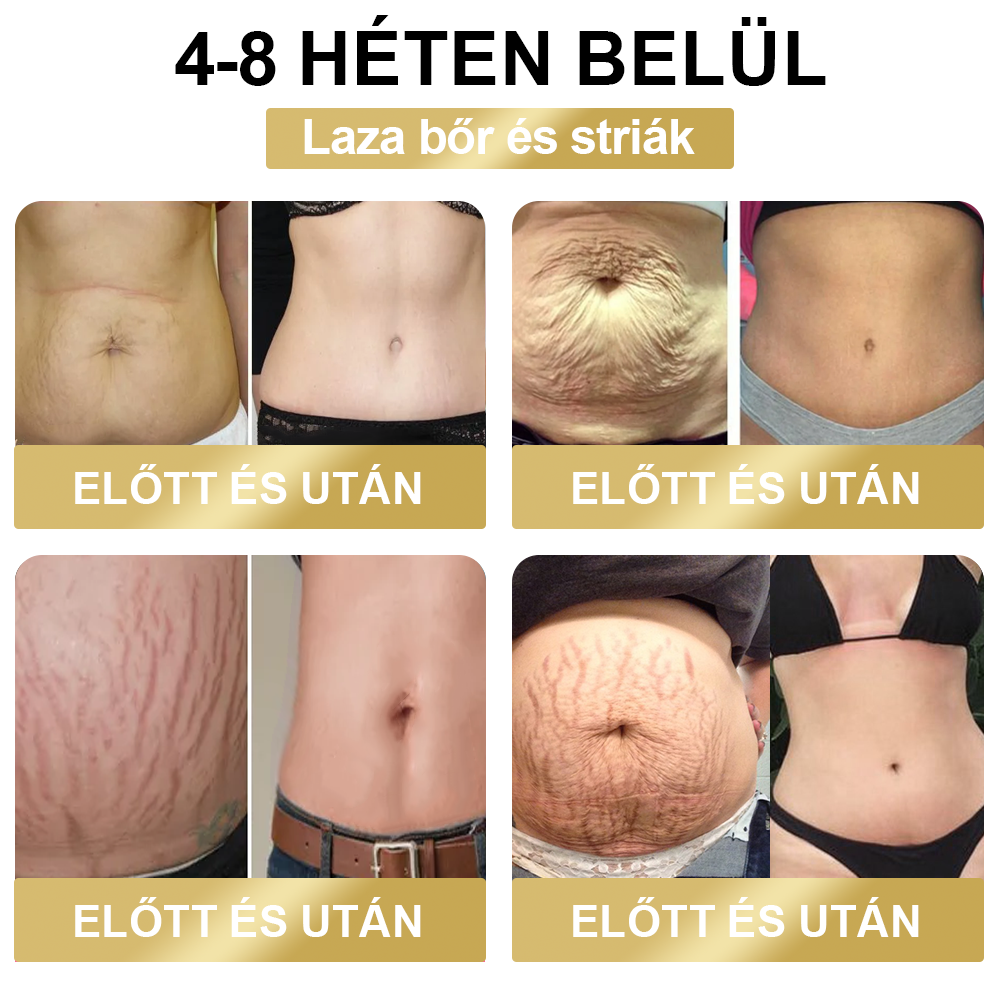 🐝❤️ 80% kedvezmény - [Kalifornia, USA-ban fejlesztve] 👨‍⚕️🌿 Méh Venom Limfatisztikus Drenázs Fogyókúrás Ragasztópánt (Minden korosztály által alkalmazható) 🔥