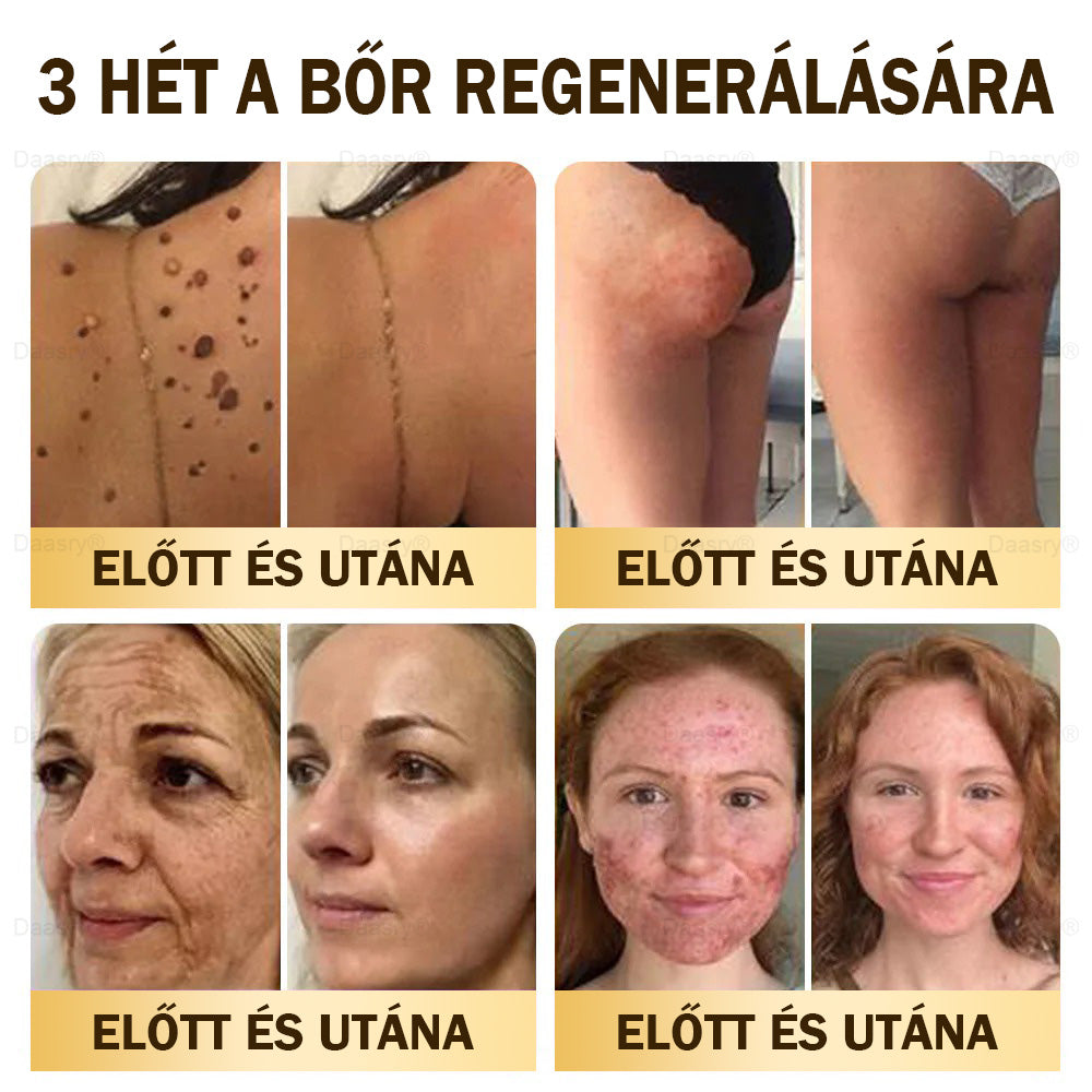 Gratulálunk! Ön a mai 500. vásárlónk, ezért egy különleges ajánlatban részesül: a második terméket 30% kedvezménnyel vásárolhatja meg! 𝓓𝓪𝓪𝓼𝓻𝔂®