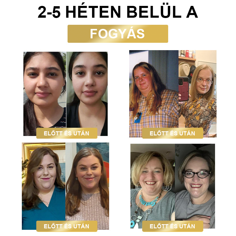 🐝❤️ 80% kedvezmény - [Kalifornia, USA-ban fejlesztve] 👨‍⚕️🌿 Méh Venom Limfatisztikus Drenázs Fogyókúrás Ragasztópánt (Minden korosztály által alkalmazható) 🔥