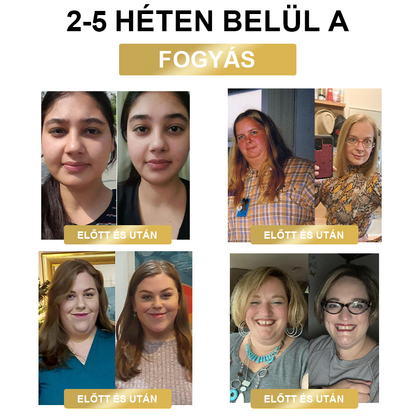 🐝❤️ 80% kedvezmény - [Kalifornia, USA-ban fejlesztve] 👨‍⚕️🌿 Méh Venom Limfatisztikus Drenázs Fogyókúrás Ragasztópánt (Minden korosztály által alkalmazható) 🔥