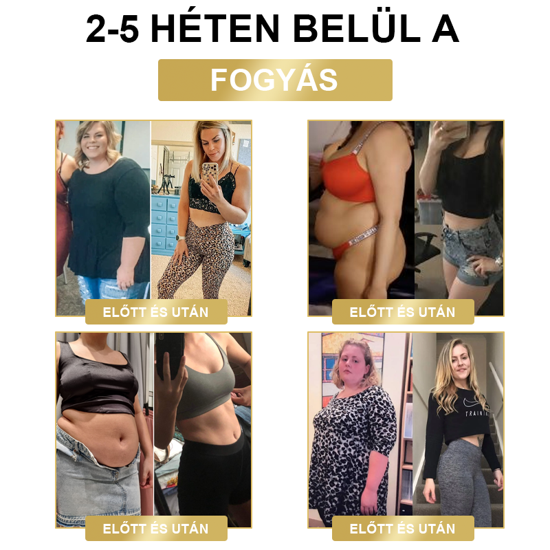 🐝❤️ 80% kedvezmény - [Kalifornia, USA-ban fejlesztve] 👨‍⚕️🌿 Méh Venom Limfatisztikus Drenázs Fogyókúrás Ragasztópánt (Minden korosztály által alkalmazható) 🔥