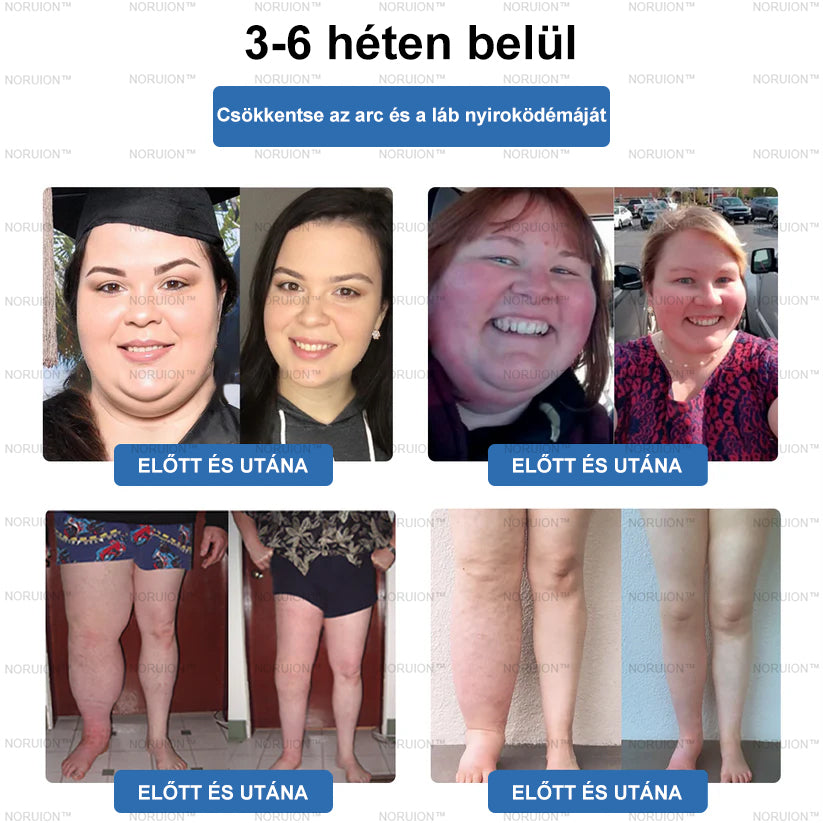 Csak 5 darab maradt! Azonnal élvezze az exkluzív 50%-os kedvezményt! Csak 1-4 hét alatt megőrizheti egészséges, tökéletes alakját. Ez az ajánlat jövőre ismét elérhető lesz. Ne hagyja ki a lehetőséget, 180 napos pénzvisszafizetési garanciát kínálunk!