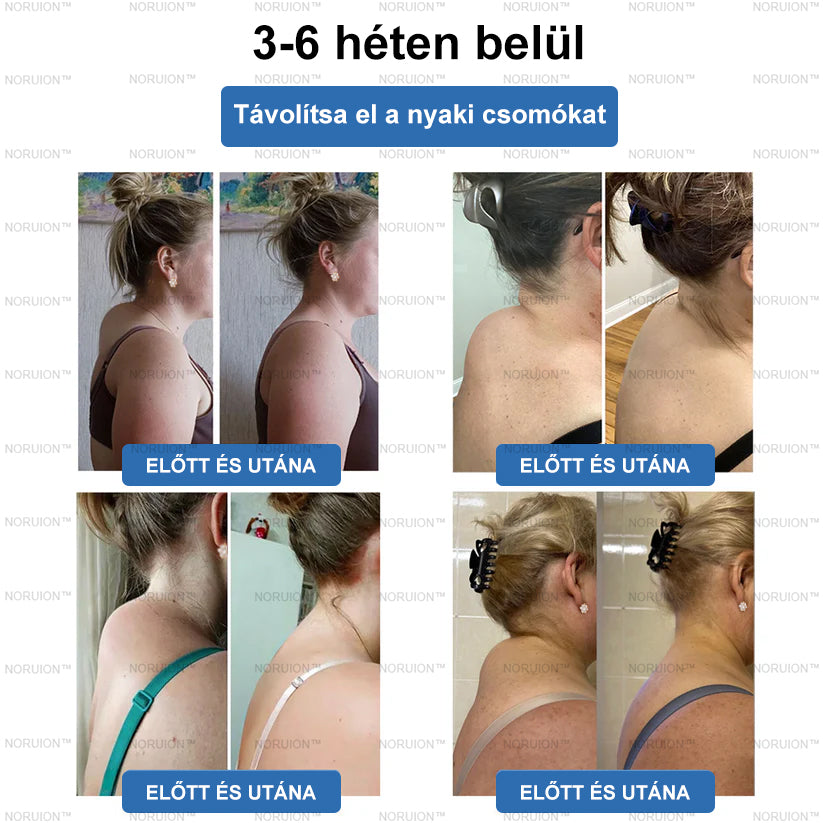 Csak 5 darab maradt! Azonnal élvezze az exkluzív 50%-os kedvezményt! Csak 1-4 hét alatt megőrizheti egészséges, tökéletes alakját. Ez az ajánlat jövőre ismét elérhető lesz. Ne hagyja ki a lehetőséget, 180 napos pénzvisszafizetési garanciát kínálunk!