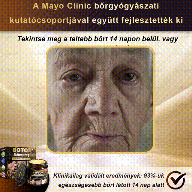 (🎁2025-ös promóció🎁 50% Kedvezmény🎁)Allybee® Botox Bőrápoló Krém US Bőrgyógyászatilag elfogadott