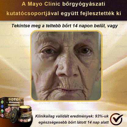 (🎁2025-ös promóció🎁 50% Kedvezmény🎁)Allybee® Botox Bőrápoló Krém US Bőrgyógyászatilag elfogadott