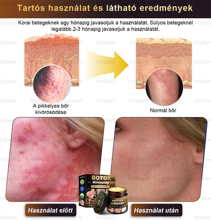 (🎁2025-ös promóció🎁 50% Kedvezmény🎁)Allybee® Botox Bőrápoló Krém US Bőrgyógyászatilag elfogadott