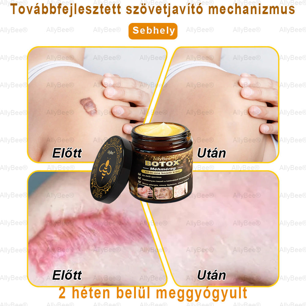 (🎁2025-ös promóció🎁 50% Kedvezmény🎁)Allybee® Botox Bőrápoló Krém US Bőrgyógyászatilag elfogadott