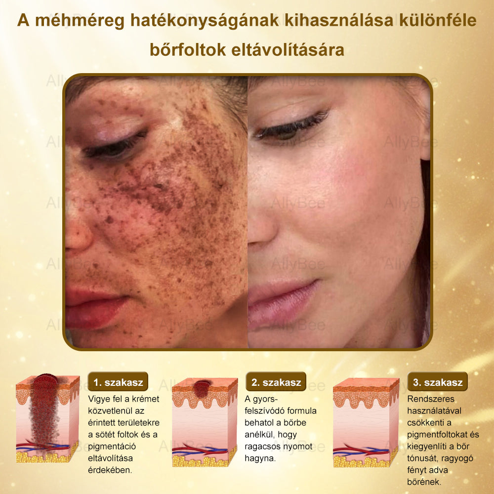 (🎁2025-ös promóció🎁 50% Kedvezmény🎁)Allybee® Botox Bőrápoló Krém US Bőrgyógyászatilag elfogadott