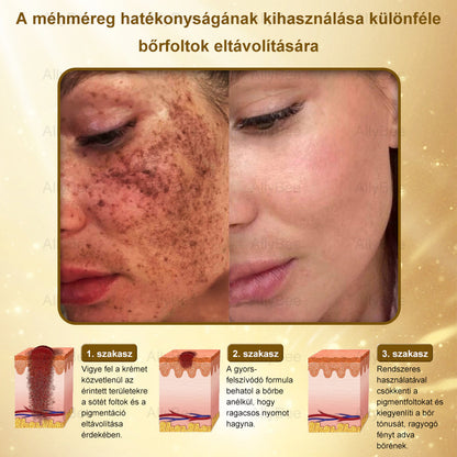 (🎁2025-ös promóció🎁 50% Kedvezmény🎁)Allybee® Botox Bőrápoló Krém US Bőrgyógyászatilag elfogadott