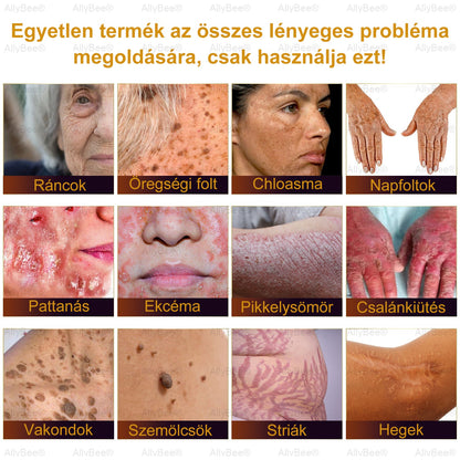 (🎁2025-ös promóció🎁 50% Kedvezmény🎁)Allybee® Botox Bőrápoló Krém US Bőrgyógyászatilag elfogadott
