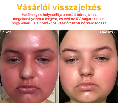 🐝💖BSWELL® Méhméreg Kezelés Krém👨‍⚕️（AAD ajánlott） (🔥utolsó nap promóció 80% ki）