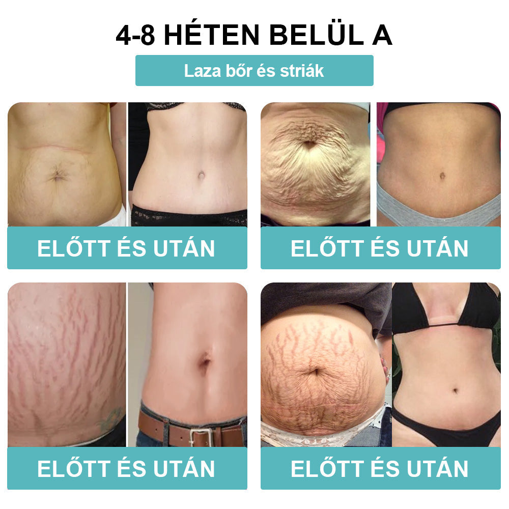 🎁 Már csak 5 darab maradt! További 50% kedvezményt kínálunk Önnek! Maradjon egészséges, tartsa formáját. Kezdjen el fogyni most, mert jövőre már nem lesz lehetősége.