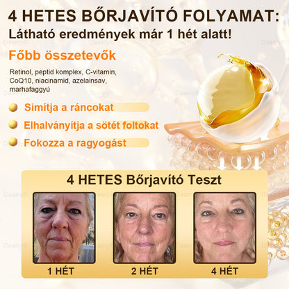 Gratulálunk! Ön a mai 500. vásárlónk, ezért egy különleges ajánlatban részesül: a második terméket 30% kedvezménnyel vásárolhatja meg! 𝓓𝓪𝓪𝓼𝓻𝔂®