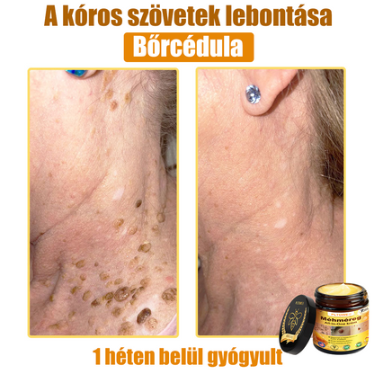 (🎁2025-ös Újévi Akció🎁 50% Kedvezmény🎁)PLTOWE® Méhméreg All-in-One krém US Bőrgyógyászatilag elfogadott