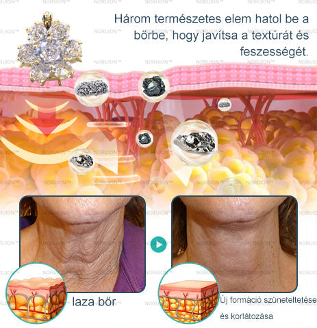 Csak 5 darab maradt! Azonnal élvezze az exkluzív 50%-os kedvezményt! Csak 1-4 hét alatt megőrizheti egészséges, tökéletes alakját. Ez az ajánlat jövőre ismét elérhető lesz. Ne hagyja ki a lehetőséget, 180 napos pénzvisszafizetési garanciát kínálunk!