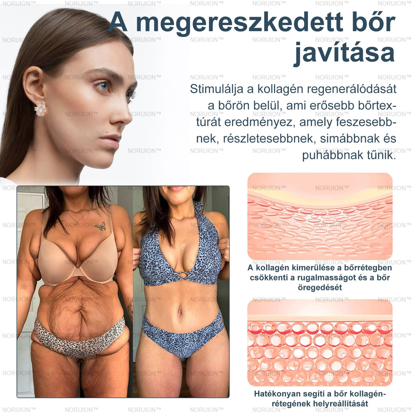 Csak 5 darab maradt! Azonnal élvezze az exkluzív 50%-os kedvezményt! Csak 1-4 hét alatt megőrizheti egészséges, tökéletes alakját. Ez az ajánlat jövőre ismét elérhető lesz. Ne hagyja ki a lehetőséget, 180 napos pénzvisszafizetési garanciát kínálunk!