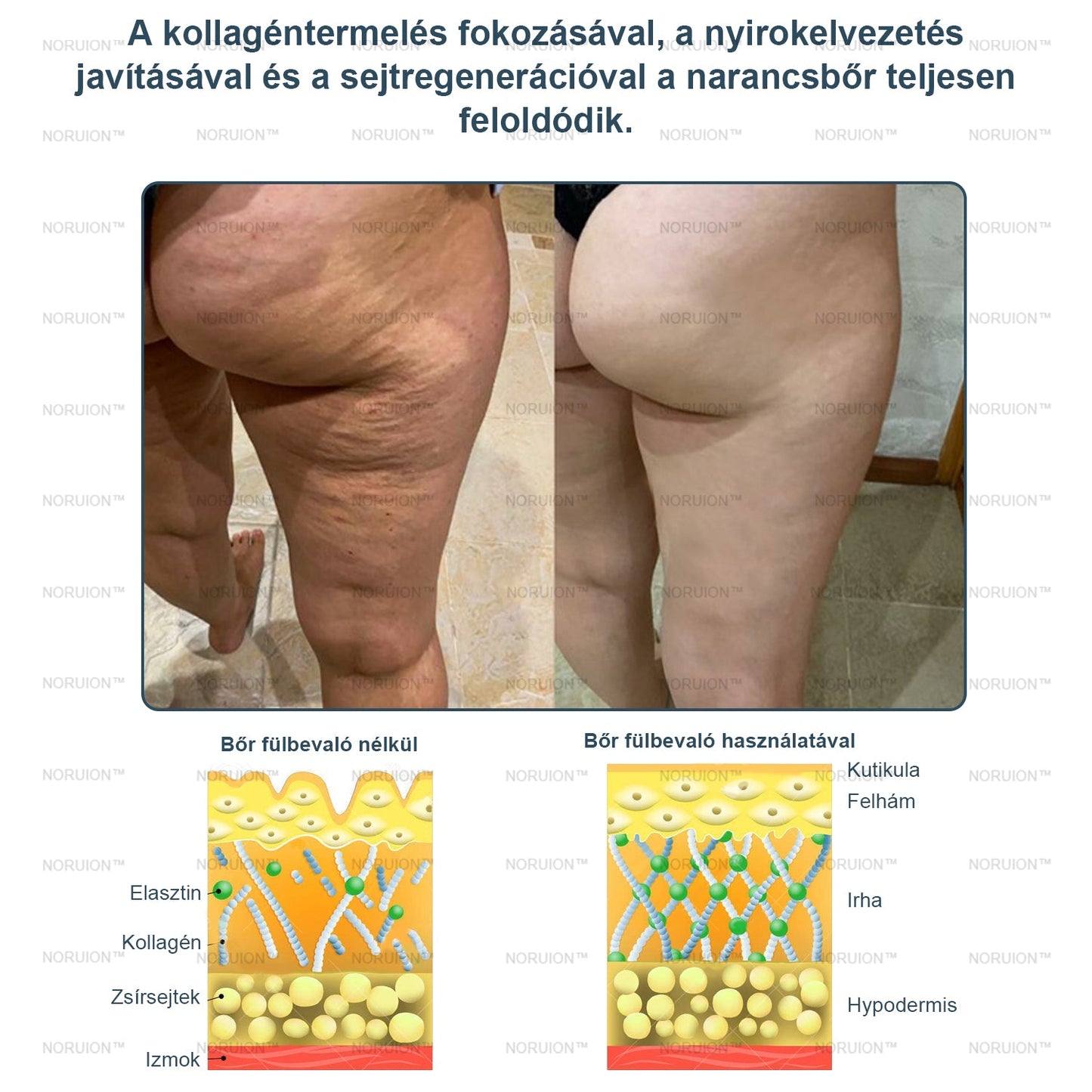 Csak 5 darab maradt! Azonnal élvezze az exkluzív 50%-os kedvezményt! Csak 1-4 hét alatt megőrizheti egészséges, tökéletes alakját. Ez az ajánlat jövőre ismét elérhető lesz. Ne hagyja ki a lehetőséget, 180 napos pénzvisszafizetési garanciát kínálunk!