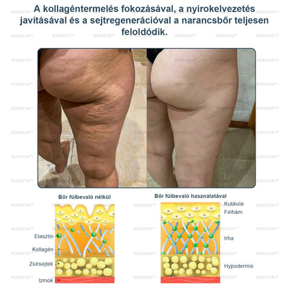 Csak 5 darab maradt! Azonnal élvezze az exkluzív 50%-os kedvezményt! Csak 1-4 hét alatt megőrizheti egészséges, tökéletes alakját. Ez az ajánlat jövőre ismét elérhető lesz. Ne hagyja ki a lehetőséget, 180 napos pénzvisszafizetési garanciát kínálunk!