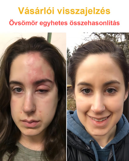 🐝💖BSWELL® Méhméreg Kezelés Krém👨‍⚕️（AAD ajánlott） (🔥utolsó nap promóció 80% ki）