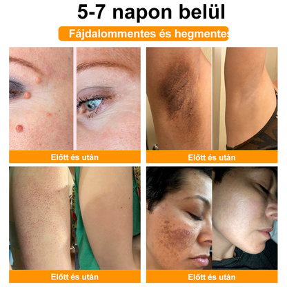 🐝💖 Csak 5 üveg maradt! További 50% kedvezményt kínálunk! Formáld magad és légy egészséges. Ha most lemaradsz, jövőre nem lesz újabb lehetőséged.