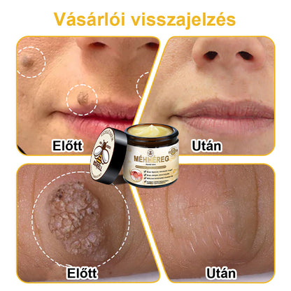 🐝💖 Csak 5 üveg maradt! További 50% kedvezményt kínálunk! Formáld magad és légy egészséges. Ha most lemaradsz, jövőre nem lesz újabb lehetőséged.