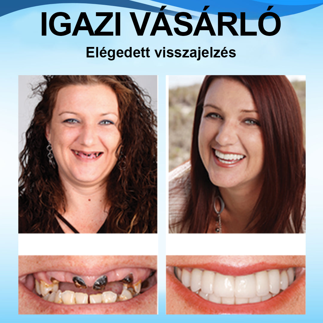 🌤️𝑺𝒎𝒊𝒍𝒆𝒉𝒑𝒚™ 𝑺𝒛𝒊𝒍𝒊𝒌𝒐𝒏 𝑭𝒐𝒈𝒔𝒐𝒓 𝑨𝒍á𝒃é𝒍𝒆𝒍ő 𝑲é𝒔𝒛𝒍𝒆𝒕