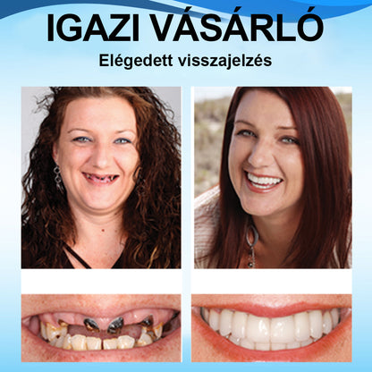 🌤️𝑺𝒎𝒊𝒍𝒆𝒉𝒑𝒚™ 𝑺𝒛𝒊𝒍𝒊𝒌𝒐𝒏 𝑭𝒐𝒈𝒔𝒐𝒓 𝑨𝒍á𝒃é𝒍𝒆𝒍ő 𝑲é𝒔𝒛𝒍𝒆𝒕