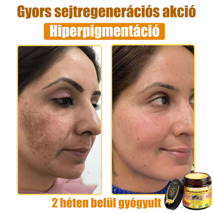 (🎁2025-ös Újévi Akció🎁 50% Kedvezmény🎁)PLTOWE® Méhméreg All-in-One krém US Bőrgyógyászatilag elfogadott