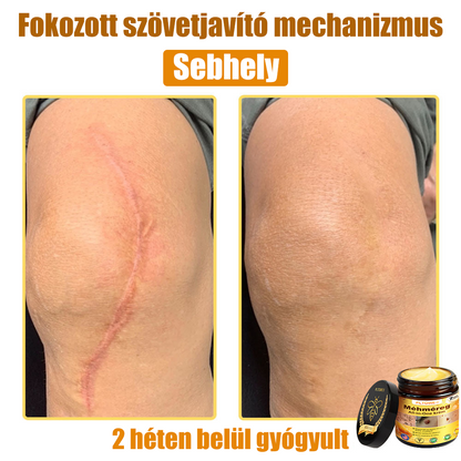 (🎁2025-ös Újévi Akció🎁 50% Kedvezmény🎁)PLTOWE® Méhméreg All-in-One krém US Bőrgyógyászatilag elfogadott