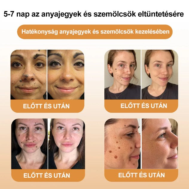 🐝💖BSWELL® Méhméreg Kezelés Krém👨‍⚕️（AAD ajánlott） (🔥utolsó nap promóció 80% ki）