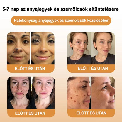 🐝💖BSWELL® Méhméreg Kezelés Krém👨‍⚕️（AAD ajánlott） (🔥utolsó nap promóció 80% ki）