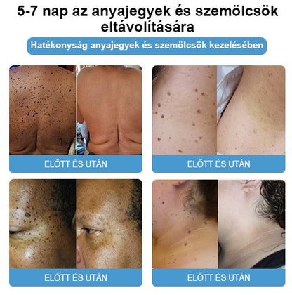 🐝💖BSWELL® Méhméreg Kezelés Krém👨‍⚕️（AAD ajánlott） (🔥utolsó nap promóció 80% ki）