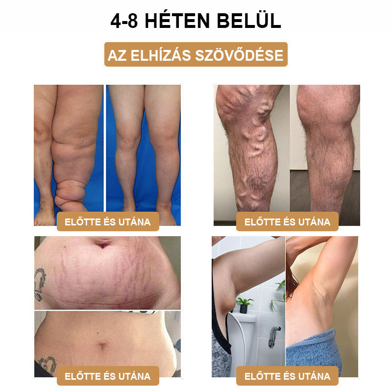 Csak 5 darab maradt! Azonnal élvezze az exkluzív 50%-os kedvezményt! Csak 1-4 hét alatt megőrizheti egészséges, tökéletes alakját. Ez az ajánlat jövőre ismét elérhető lesz. Ne hagyja ki a lehetőséget, 180 napos pénzvisszafizetési garanciát kínálunk!