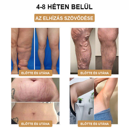 Csak 5 darab maradt! Azonnal élvezze az exkluzív 50%-os kedvezményt! Csak 1-4 hét alatt megőrizheti egészséges, tökéletes alakját. Ez az ajánlat jövőre ismét elérhető lesz. Ne hagyja ki a lehetőséget, 180 napos pénzvisszafizetési garanciát kínálunk!